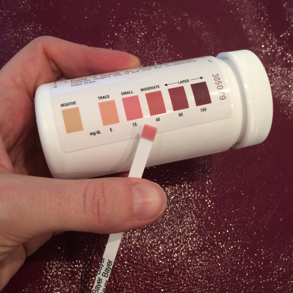 Measuring ketones in urine