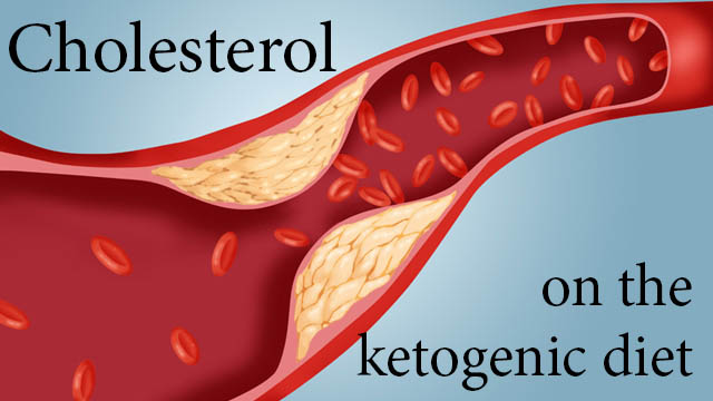 cholesterol 309 ketogenic diet